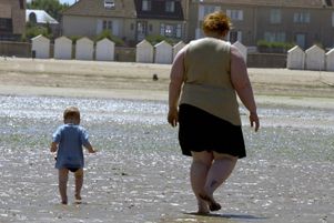 Une femme souffrant d'obésité le 9 juillet 2003
                    Courseulles, dans le Calvados.