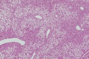 Microbiote intestinal. 