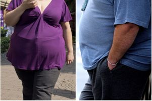 L’obésité touche aujourd’hui 650 millions d’adultes, soit 13 % de la population mondiale adulte.