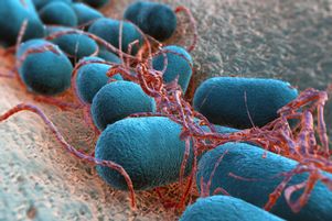 C’est la bactérie Escherichia coli (E. coli) qui est à l’origine de graves intoxications alimentaires dans l’Aisne, a confirmé le ministre de la santé dimanche 22 juin 2025.